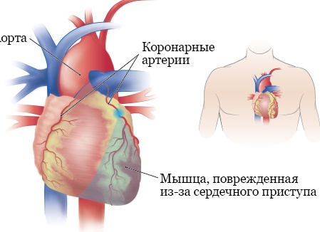 щлшноерпамвы